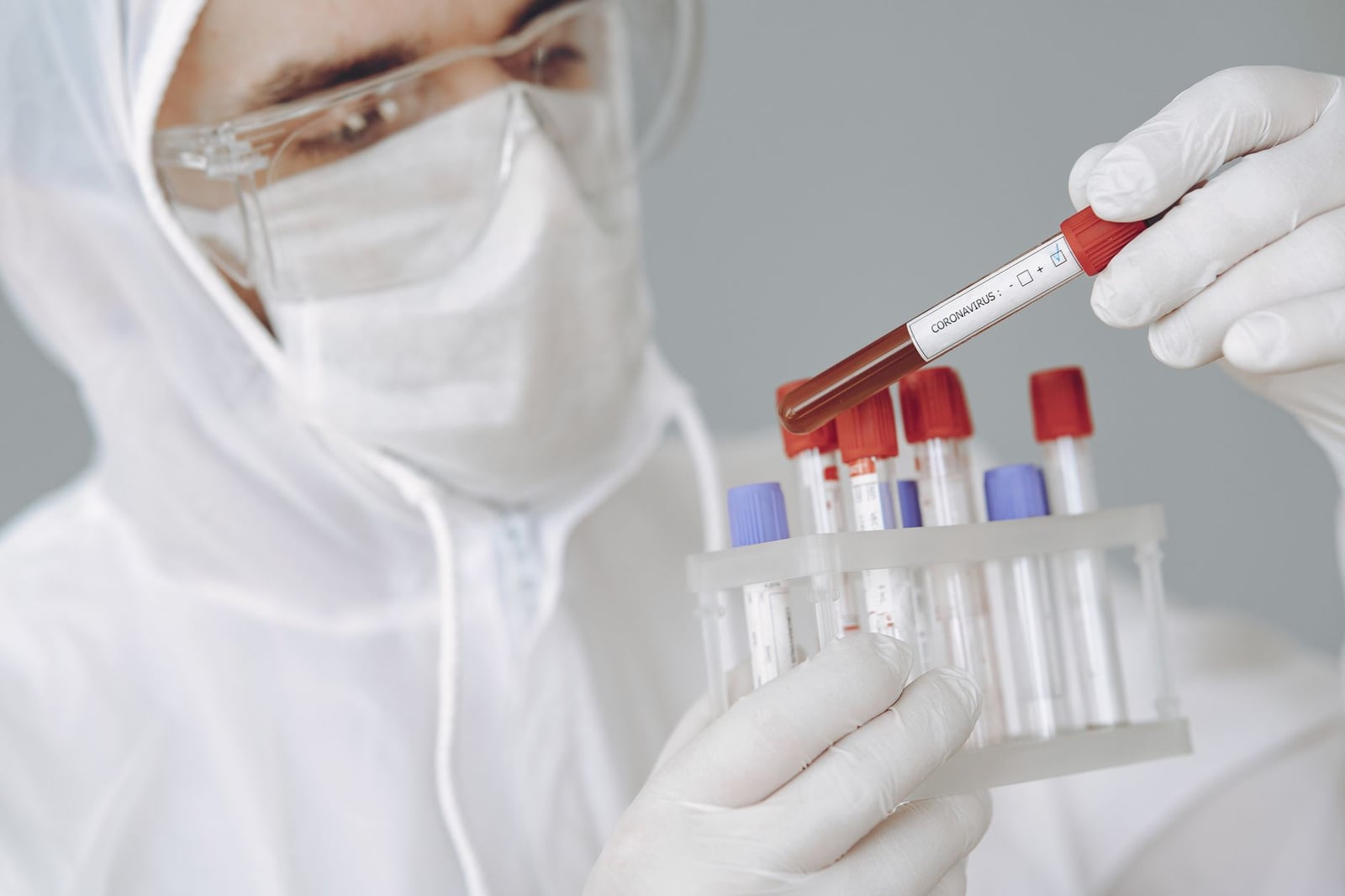 Científico con EPI trabaja en el laboratorio sosteniendo un tubo de ensayo de coronavirus con concentración enfocada.