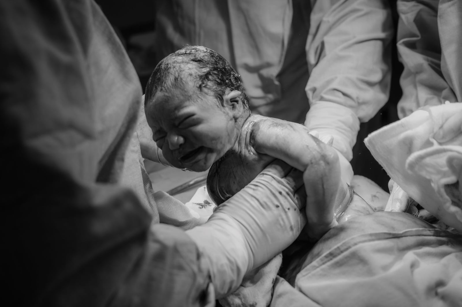 Fotografía en blanco y negro que captura el nacimiento de un recién nacido en un hospital por el personal médico.