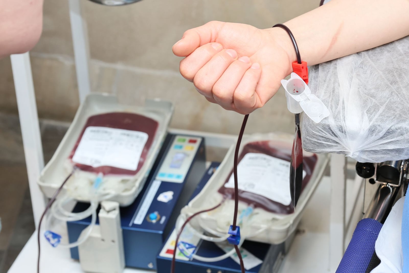 Primer plano del proceso de donación de sangre, donde se muestra el brazo de un donante y las bolsas de sangre en una clínica.